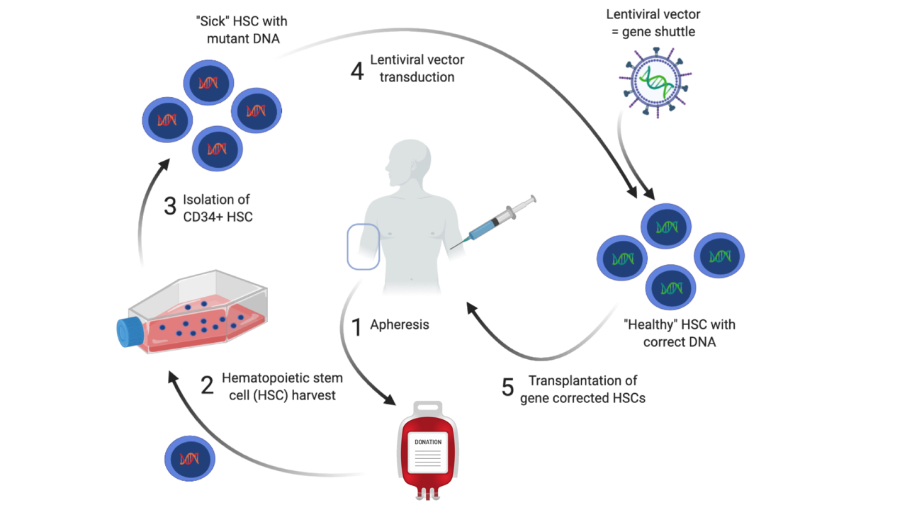 Ex vivo gene therapy